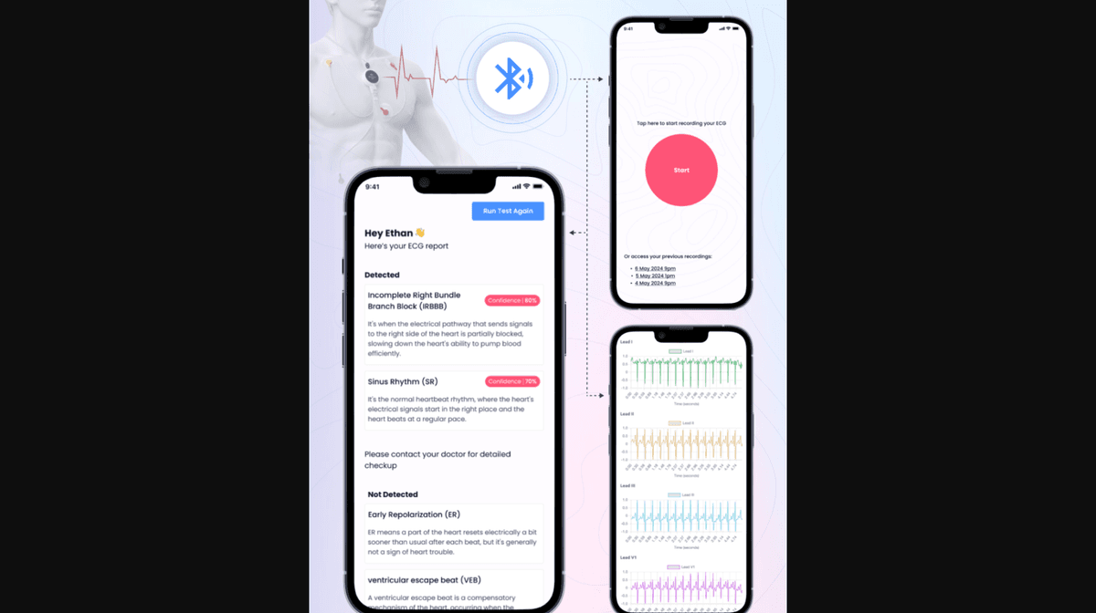 Syncardia AI ECG App